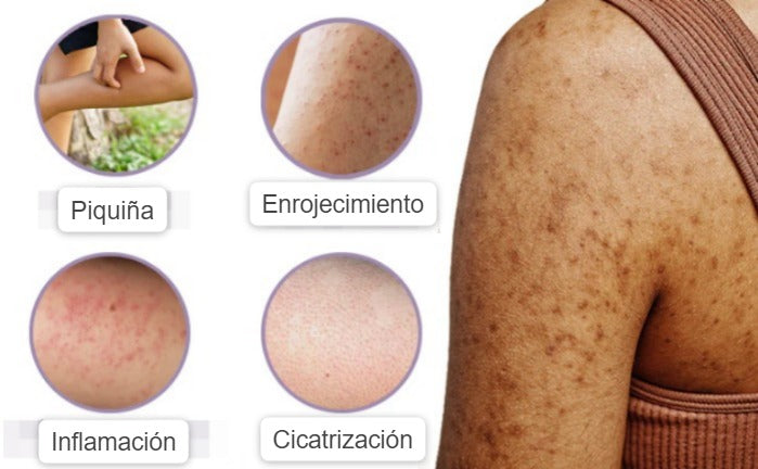 Exfoliante baba de caracol Healthy Skin™