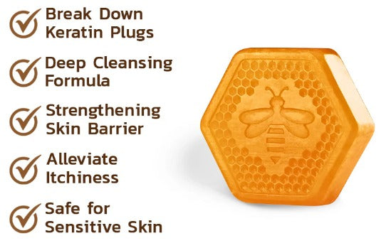 Jabón Keratone - veneno de abejas Skin Care™