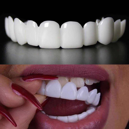 Carilla Dental Sonrisa Pro Dent