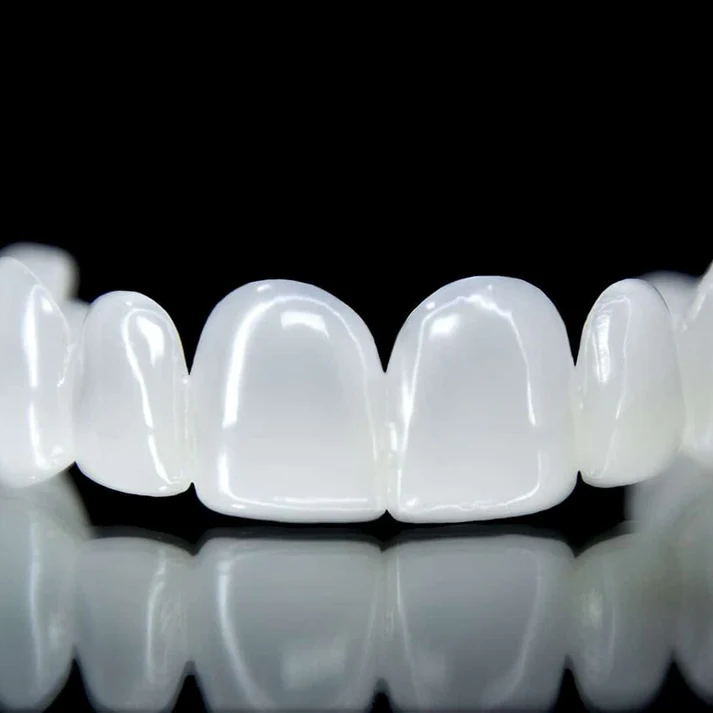 Carilla Dental Sonrisa Pro Dent