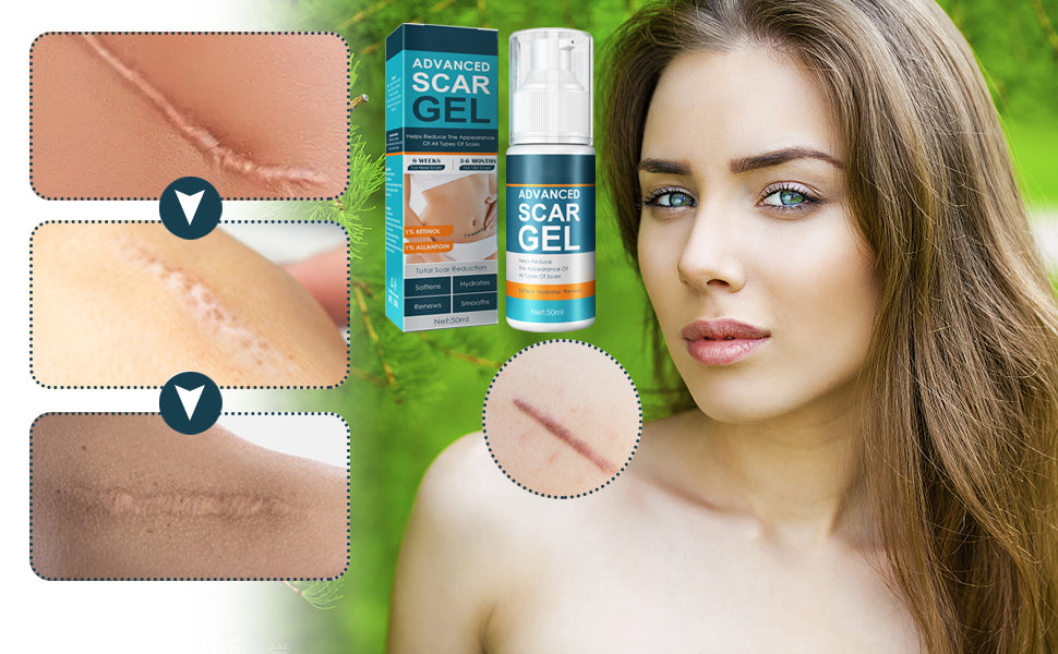 Gel anti cicatrices Pro Skin™