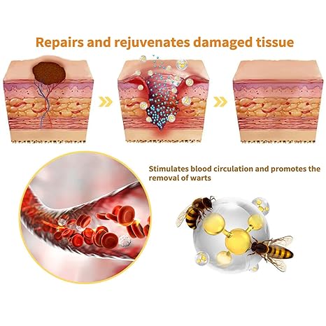 Crema anti verrugas con Veneno de Abeja Pro Health™