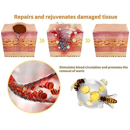Crema anti verrugas con Veneno de Abeja Pro Health™