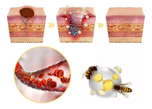 Spray de abejas Pro SkinCare™