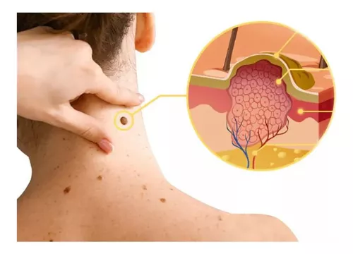 Spray de abejas Pro SkinCare™