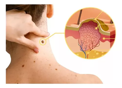 Spray de abejas Pro SkinCare™