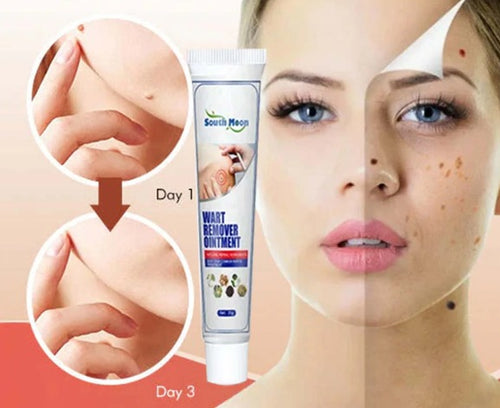 Anti Verrugas Pro™