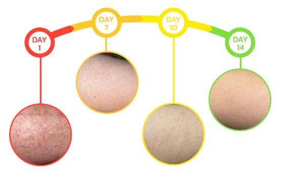 Jabón Keratone -  veneno de abejas Skin Care™