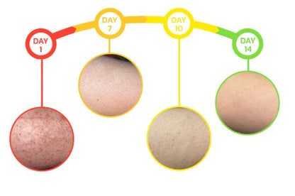 Jabón Keratone -  veneno de abejas Skin Care™