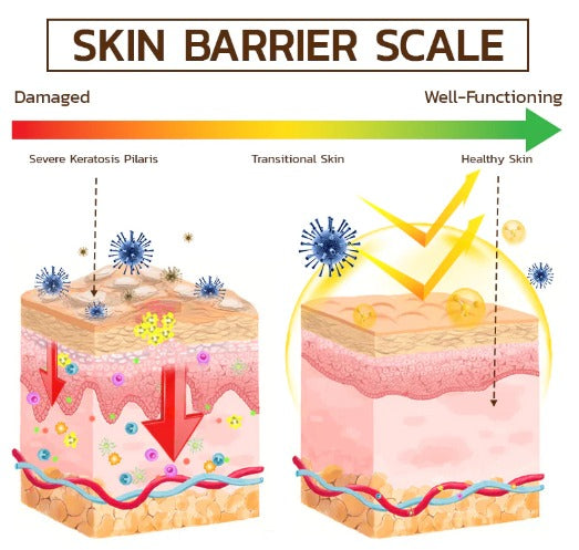Jabón Keratone -  veneno de abejas Skin Care™