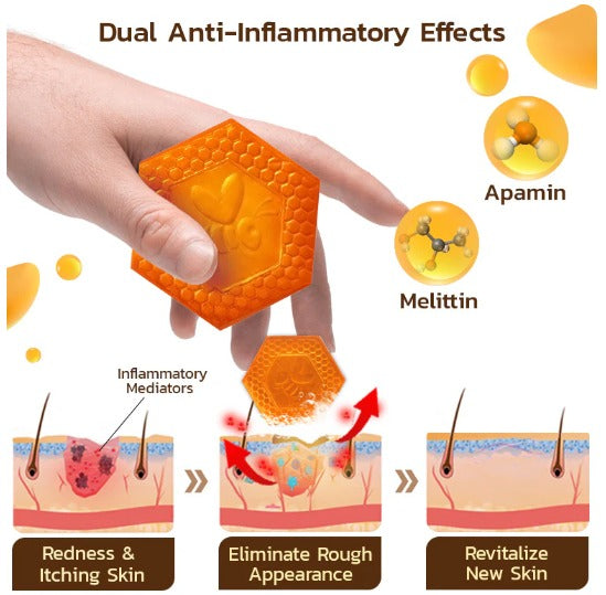 Jabón Keratone -  veneno de abejas Skin Care™