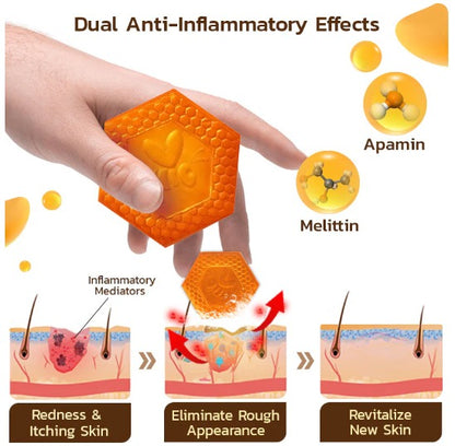 Jabón Keratone -  veneno de abejas Skin Care™