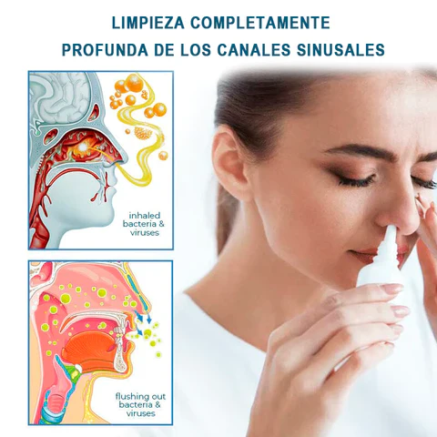 Spray para la Rinitis Salud Max