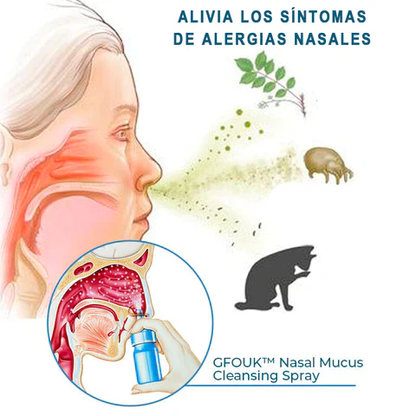 Spray para la Rinitis Salud Max