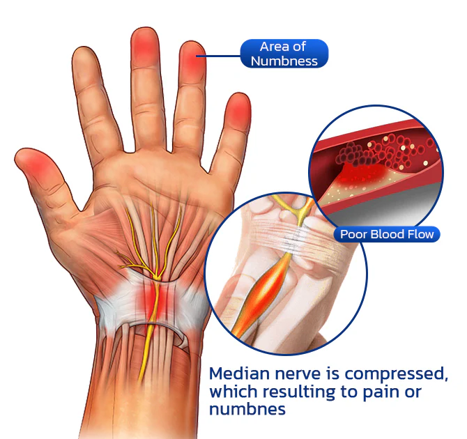 Pulsera anti entumecimiento Healthy Life™